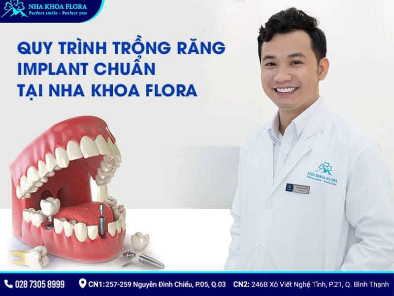 trụ implant