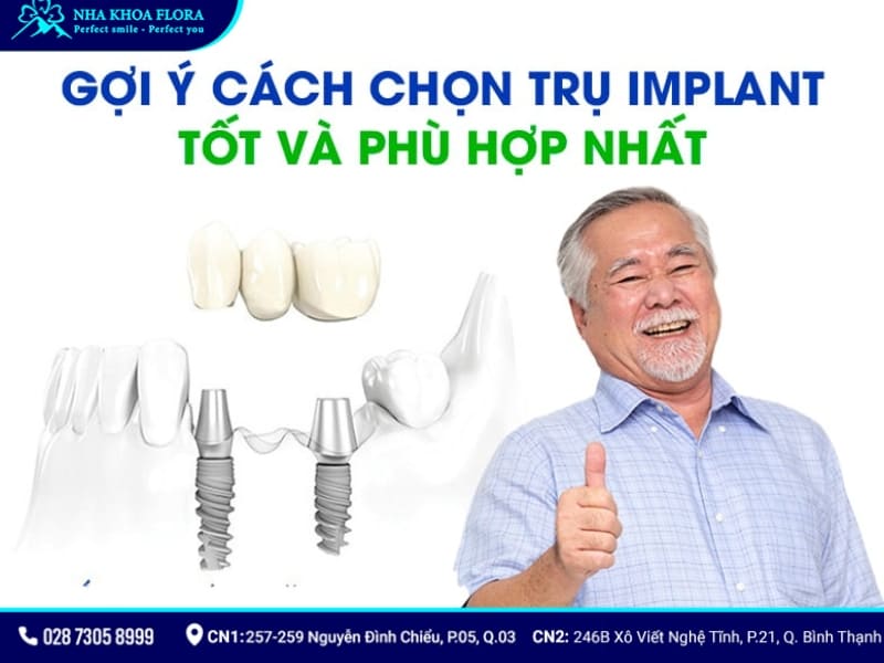 trụ implant