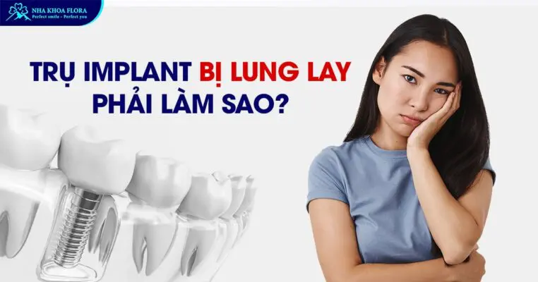 Trụ Implant Bị Lung Lay Phải Làm Sao? 4
