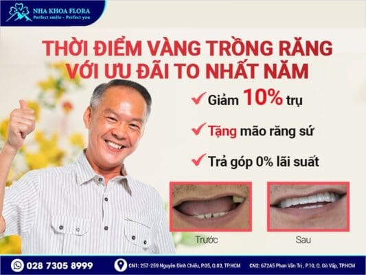 ưu đãi trồng răng - ảnh 1 ưu đãi trồng răng - ảnh 1