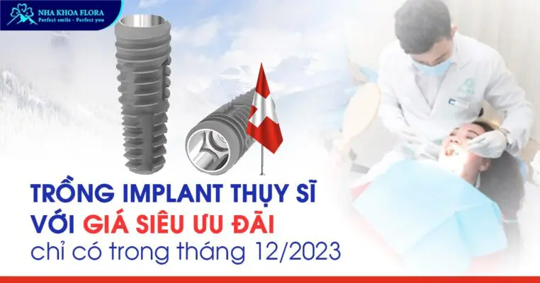 Siêu ưu đãi trồng răng Implant Thụy Sĩ hot nhất tháng 12/2023 4