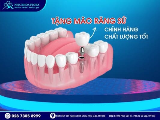 Ưu đãi trồng răng Implant Thụy Sĩ - ảnh 4 Ưu đãi trồng răng Implant Thụy Sĩ - ảnh 4