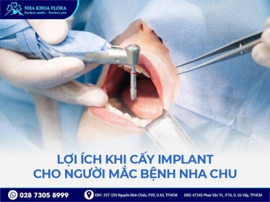 Viêm nha chu có cấy ghép implant được không - ảnh 4