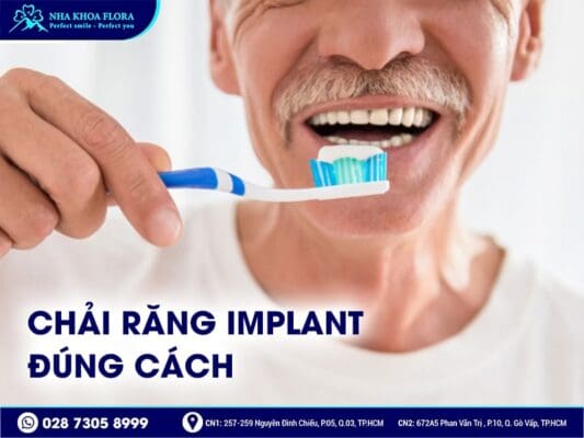 Cách vệ sinh răng Implant - ảnh 1