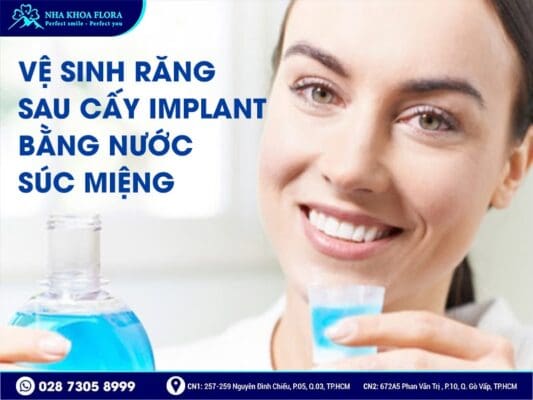 Cách vệ sinh răng Implant - ảnh 4