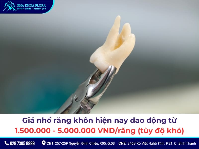 chi phí nhổ răng khôn