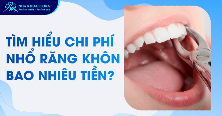 chi phí nhổ răng khôn