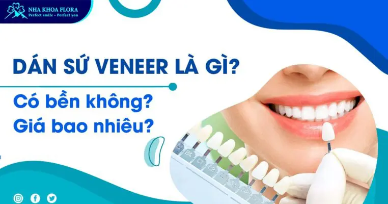 Dán sứ Veneer Là Gì? Có Bền Không? Giá Bao Nhiêu? 1