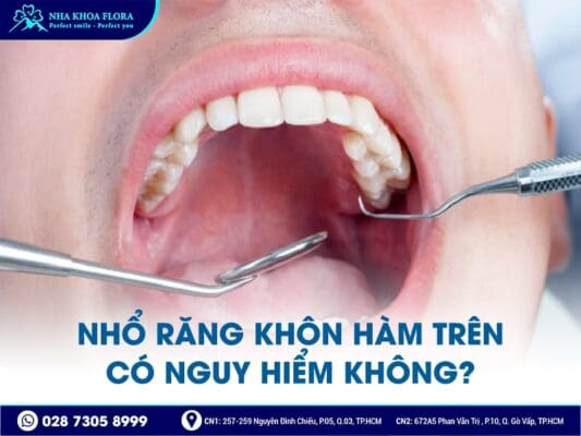 nhổ răng khôn có nguy hiểm không - ảnh 2