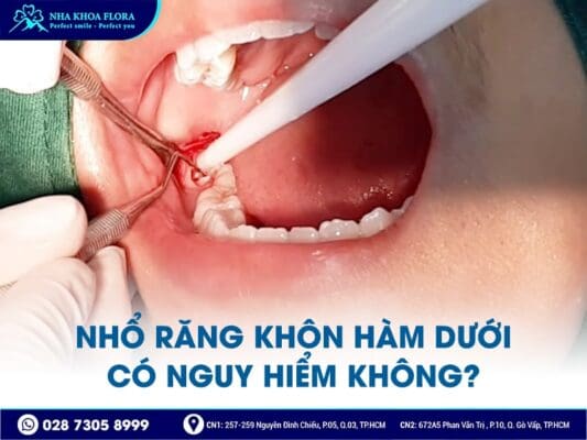 nhổ răng khôn có nguy hiểm không - ảnh 3