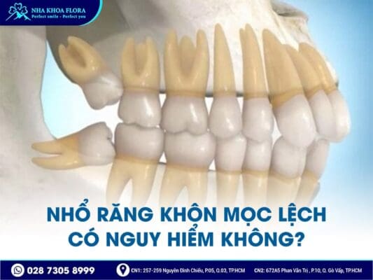 nhổ răng khôn có nguy hiểm không - ảnh 4