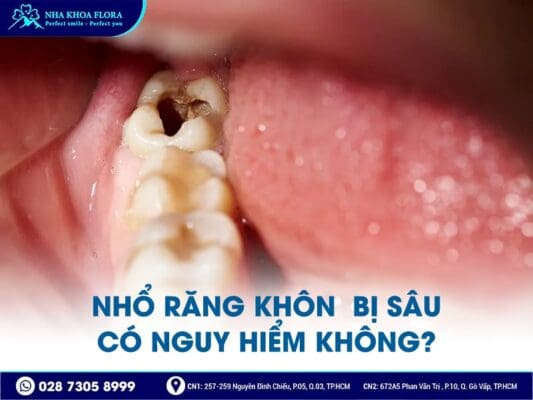 nhổ răng khôn có nguy hiểm không - ảnh 5