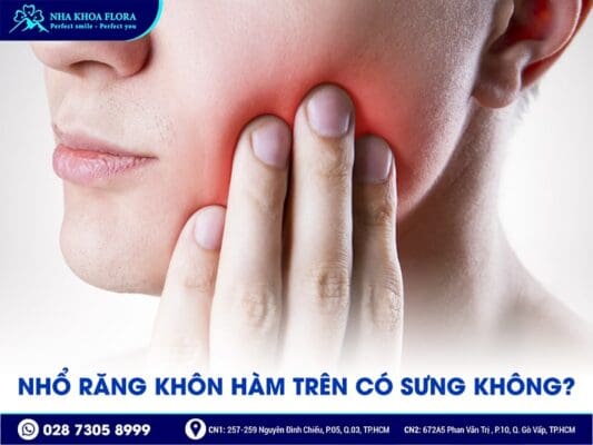 nhổ răng khôn hàm trên - ảnh 2