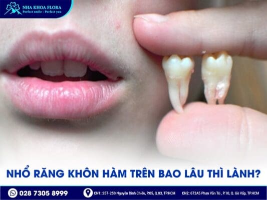 nhổ răng khôn hàm trên - ảnh 4