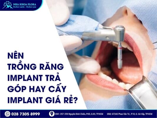Trồng răng Implant trả góp - ảnh 4