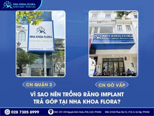 Trồng răng Implant trả góp - ảnh 2