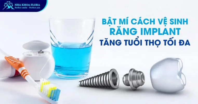 Cách Vệ Sinh Răng Implant Giúp Tăng Tuổi Thọ Tối Đa 1
