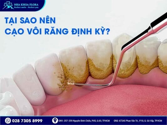 cạo vôi răng có đau không - ảnh 1