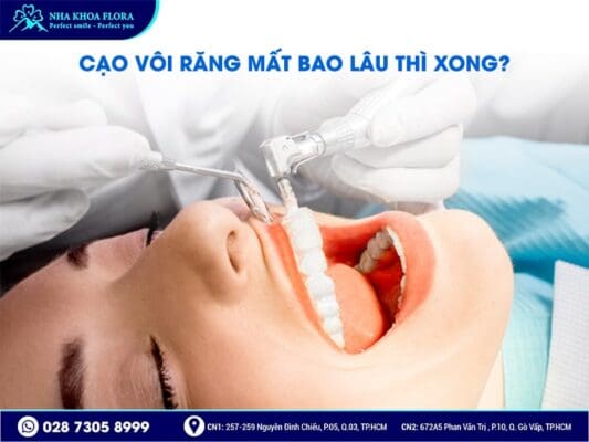 Cạo vôi răng có làm trắng răng không - ảnh 3