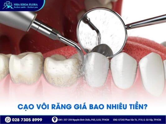 Cạo vôi răng giá bao nhiêu - ảnh 1