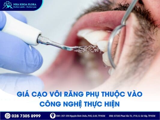 Cạo vôi răng giá bao nhiêu - ảnh 2