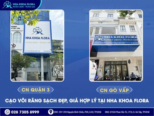 Cạo vôi răng giá bao nhiêu - ảnh 4