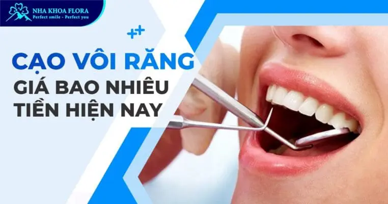 Cạo vôi răng giá bao nhiêu tiền tại Nha khoa Flora? 11
