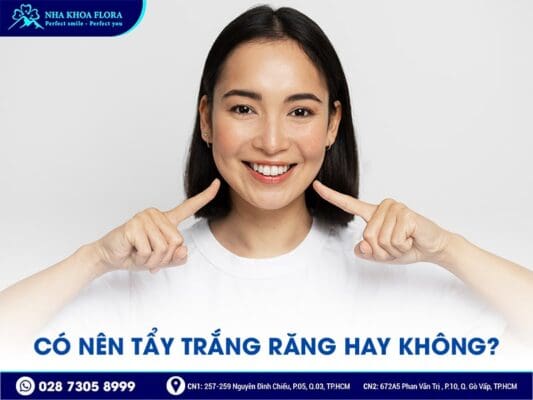 có nên tẩy trắng răng - ảnh 1