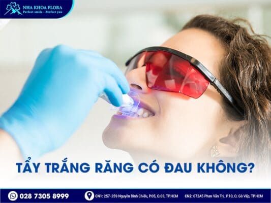 có nên tẩy trắng răng - ảnh 3