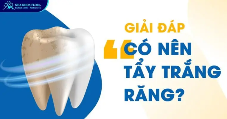 Có Nên Tẩy Trắng Răng? – Bác Sĩ Tư Vấn Miễn Phí 1