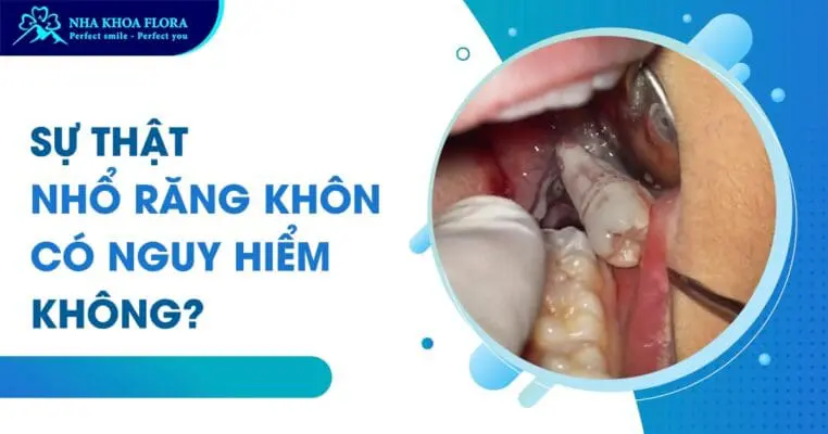 Sự thật nhổ răng khôn có nguy hiểm không? 3