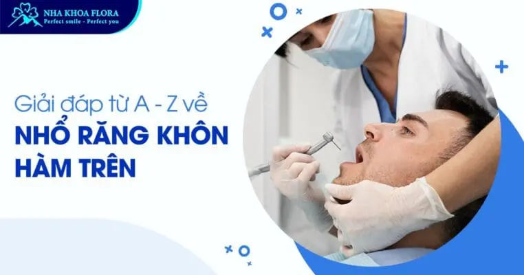 Giải đáp từ A – Z về nhổ răng khôn hàm trên 3