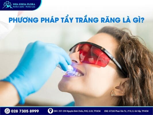 Tẩy trắng răng có hại không - ảnh 1
