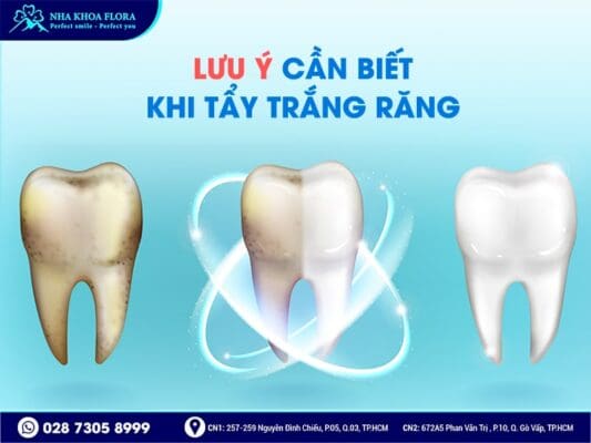 Tẩy trắng răng có hại không - ảnh 5
