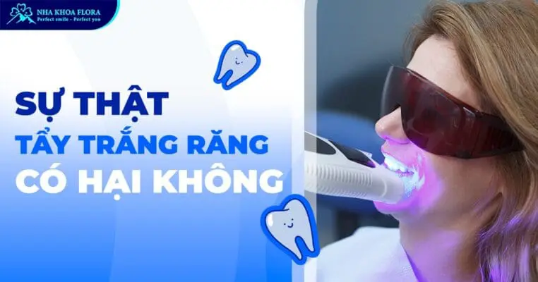 Tẩy trắng răng có hại không? Có làm hỏng men răng? 1