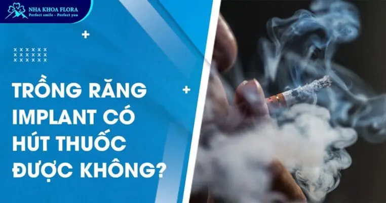 Hỏi Đáp: Trồng Răng Implant Có Hút Thuốc Được Không? 2