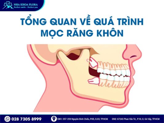 Dấu hiệu mọc răng khôn - ảnh 1