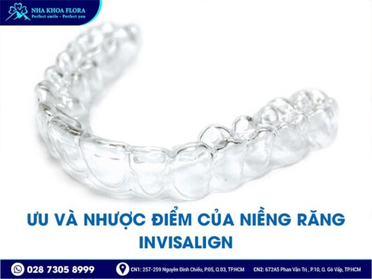Giá niềng răng Invisalign - ảnh 3