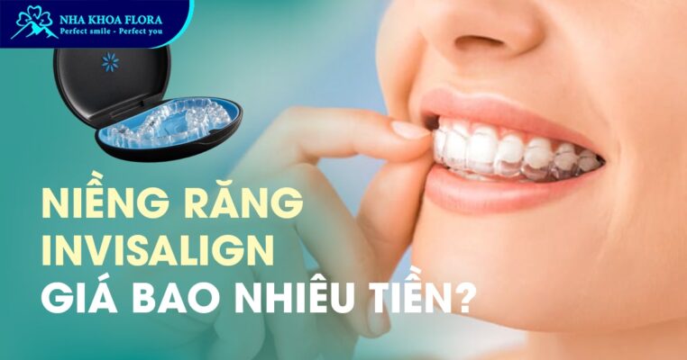 Giá niềng răng Invisalign