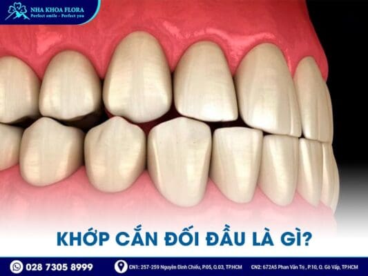 khớp cắn đối đầu - ảnh 1