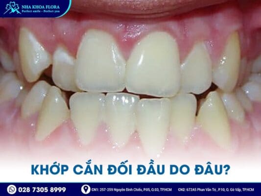 khớp cắn đối đầu - ảnh 2