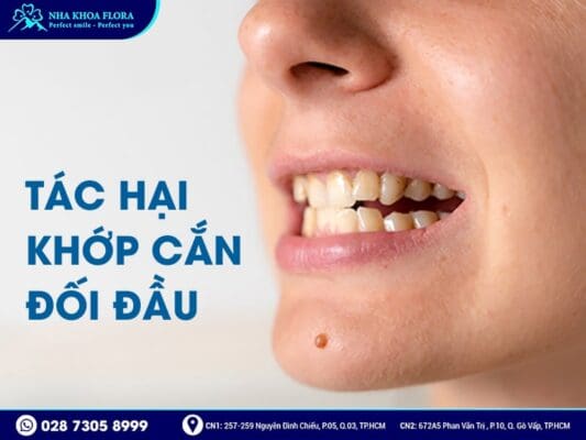 khớp cắn đối đầu - ảnh 3