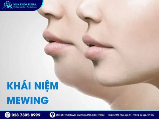 Mewing - ảnh 1 Mewing - ảnh 1