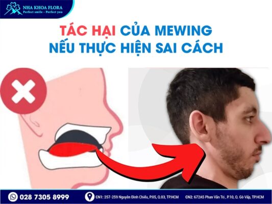 Mewing - ảnh 4 Mewing - ảnh 4