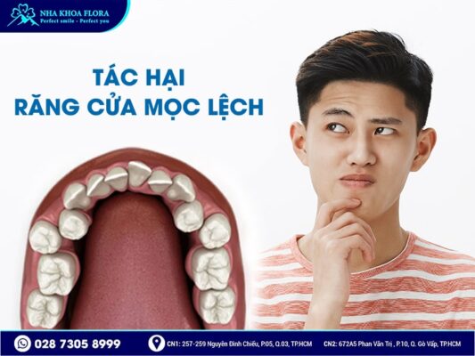 răng cửa mọc lệch - ảnh 3