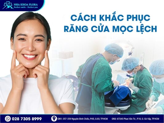 răng cửa mọc lệch - ảnh 4