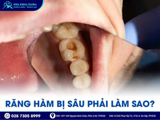 răng hàm có thay không - ảnh 3
