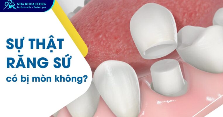 răng sứ có bị mòn không