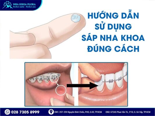 sáp nha khoa - ảnh 3