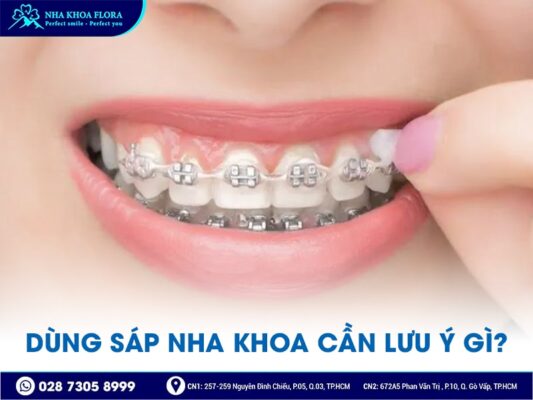 sáp nha khoa - ảnh 4